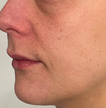 SKIN REJUVENATION.A.ANDERSEN.25.A