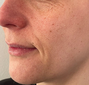 SKIN REJUVENATION.A.ANDERSEN.25.B